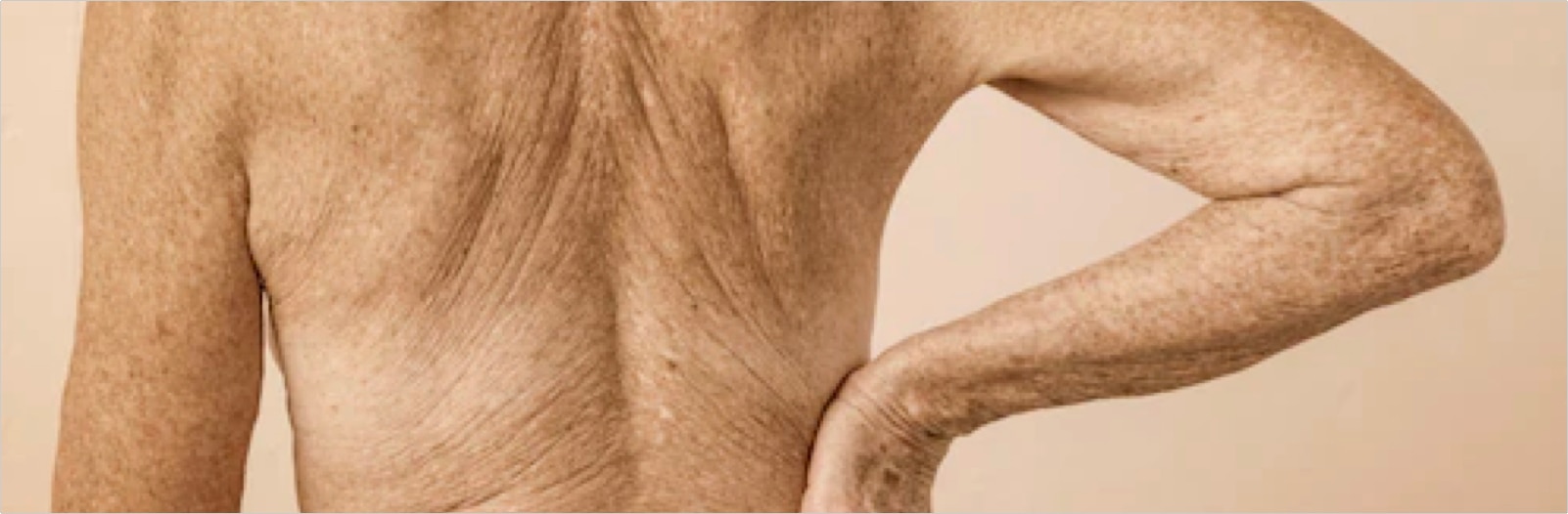 Una donna anziana di schiena mostra una sana pelle invecchiata.