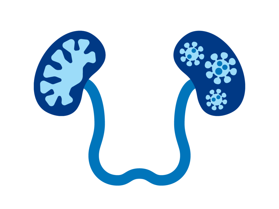 Kidney Infections Signs, Causes and Treatments TENA