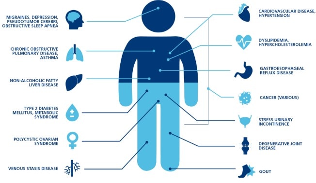 Obesity comorbidity