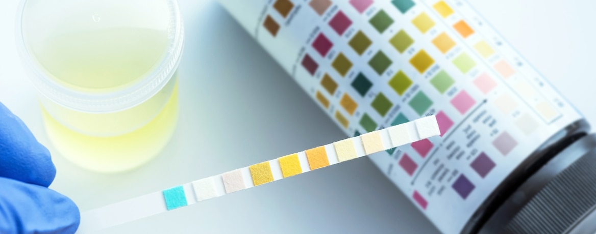Teste de urina com tira colorida