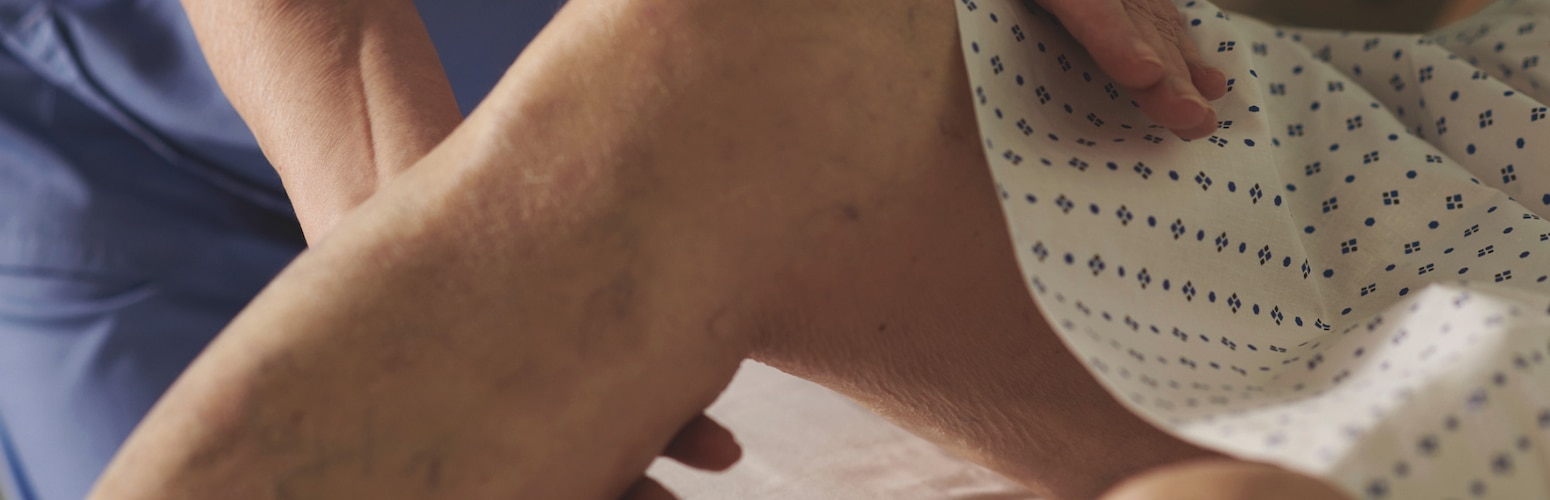 Close-up image of a caregiver inspecting the leg of an elderly nursing home resident to assess their skin health  