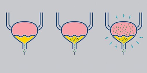 Ilustrace močového měchýře