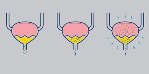 Ilustrace močového měchýře