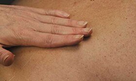 Hand applies TENA moisturising product on the skin