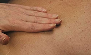 Hand applies TENA moisturizing product on the skin
