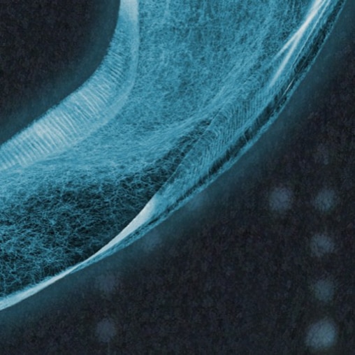 Röntgenaufnahme eines Inkontinenzprodukts, auf dem ein Ausschnitt der Fasern im saugfähigen Kern des Produkts zu sehen ist. 
