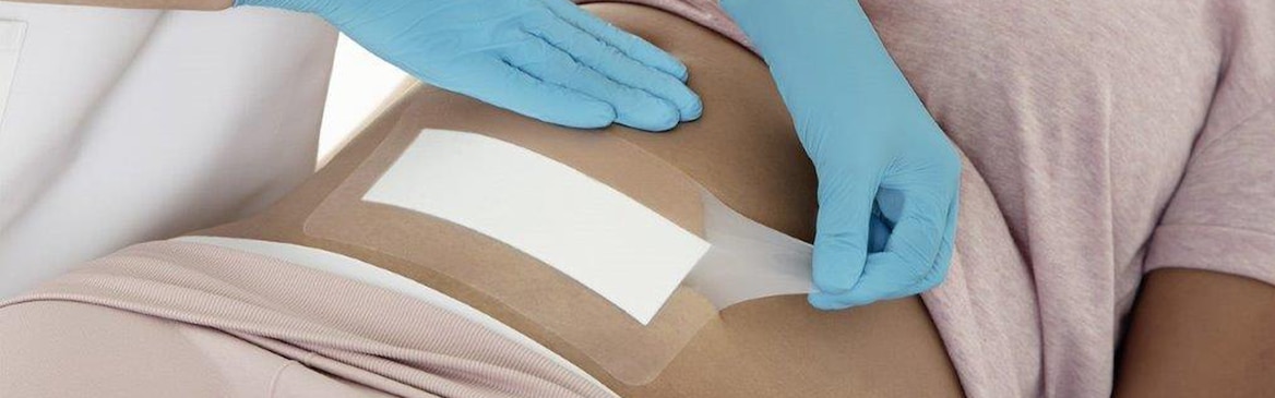 Sorbact technology-coated microbial binding post-op dressings