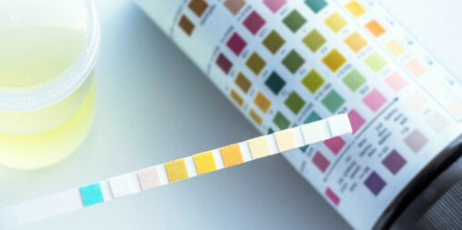 Urine test with colored stick