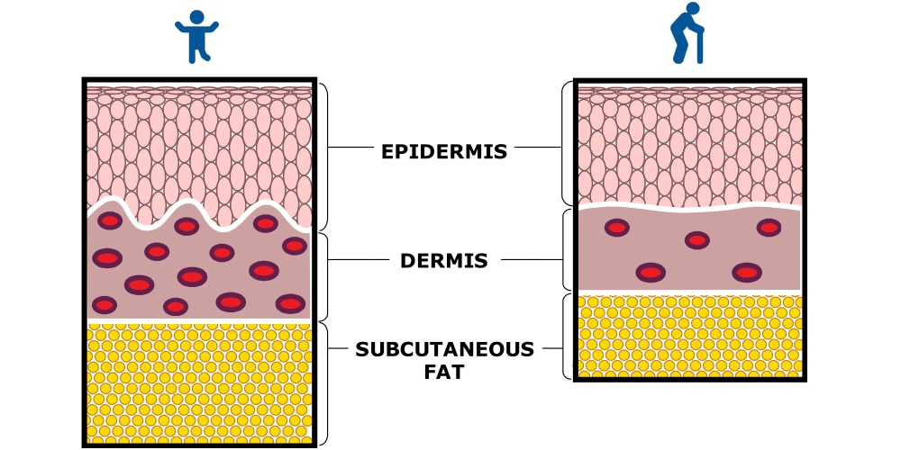 Mise au point en pensant aux personnes âgées