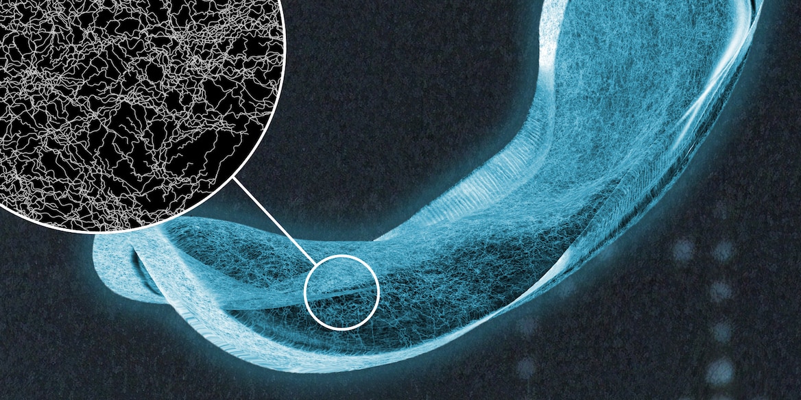 Inkontinenssisuojaa esittävä röntgenkuva, jossa näkyy yksityiskohta suojan imuytimen kuiduista 